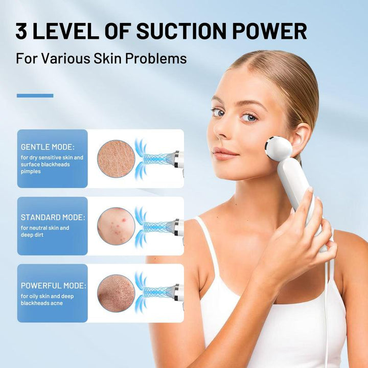 Fulog Blackhead Remover Vacuum - USB Pore Cleaner with Camera, 3 Suction Heads & Adjustable Modes - Perfect Gift for Women on Christmas & Thanksgiving!
