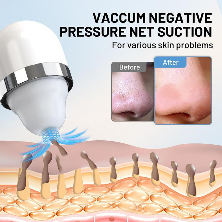 Fulog Blackhead Remover Vacuum - USB Pore Cleaner with Camera, 3 Suction Heads & Adjustable Modes - Perfect Gift for Women on Christmas & Thanksgiving!