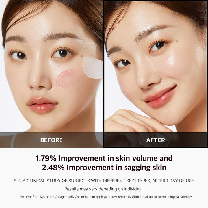 Achieve Radiant Glass Skin with the 310M Celebrity Duo: Korea's Top Glow Device & Luxe Collagen or Deep Vita C Cream!