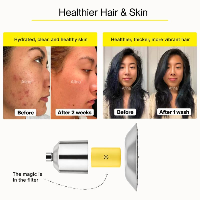 Revitalize Your Shower Experience: Afina High Pressure Filtered Shower Head for Healthier Skin, Hair & Nails - Say Goodbye to Dryness, Dandruff & Eczema!