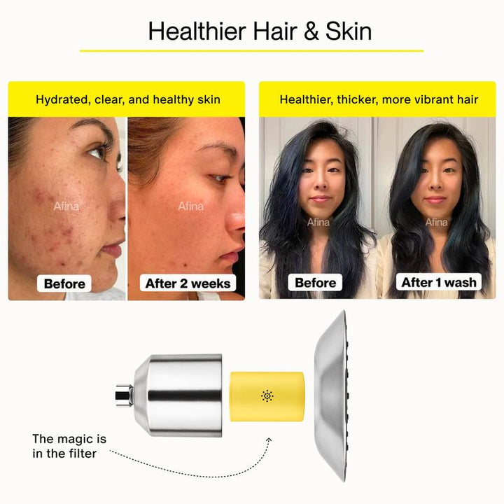 Revitalize Your Shower Experience: Afina High Pressure Filtered Shower Head for Healthier Skin, Hair & Nails - Say Goodbye to Dryness, Dandruff & Eczema!