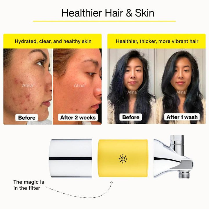 Revitalize Your Hair & Skin with the Afina Shower Filter – High Pressure Filtration for Healthier, Hydrated Beauty!