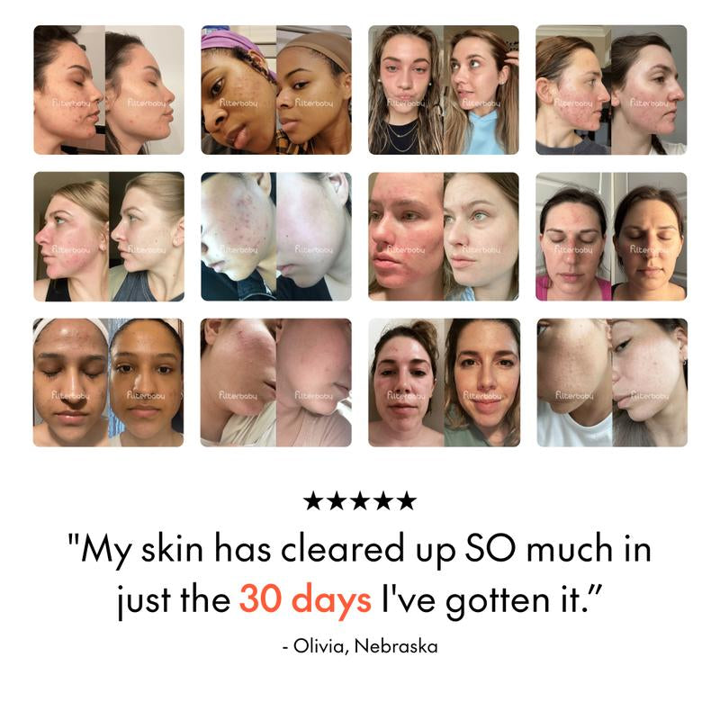 Revitalize Your Skin with Filterbaby Skincare Filter 2.0