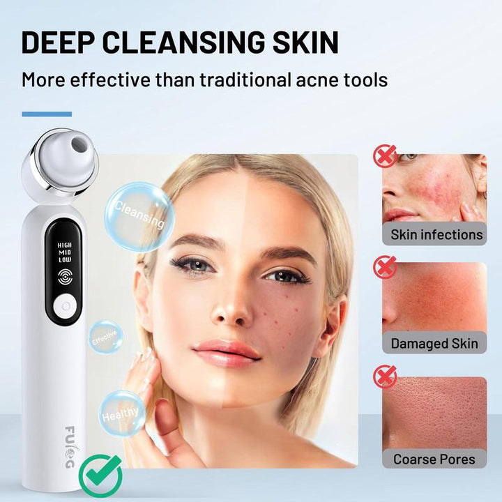 Fulog Blackhead Remover Vacuum - USB Pore Cleaner with Camera, 3 Suction Heads & Adjustable Modes - Perfect Gift for Women on Christmas & Thanksgiving!