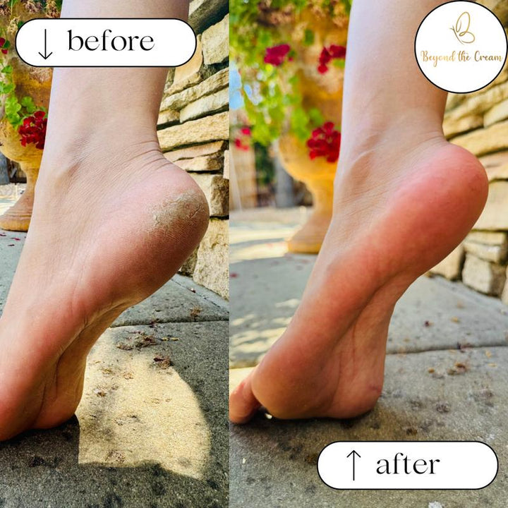 Experience Baby Soft Feet in Minutes! Beyond the Cream Foot File with Advanced Nano-Glass Technology - Ergonomic, Waterproof & Easy to Clean, Perfect Gift Packaging!