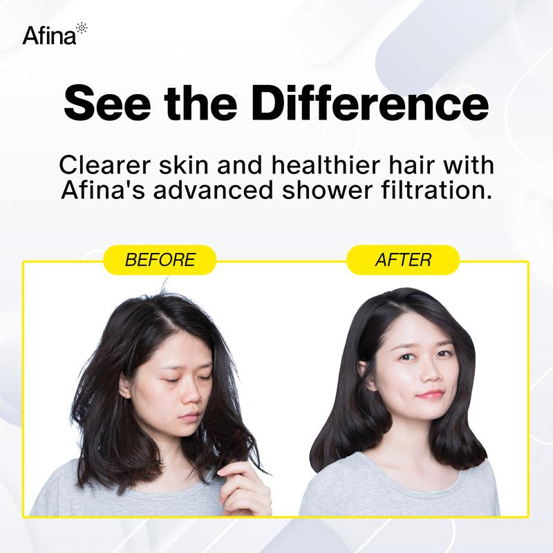 Revitalize Your Shower Experience: Afina High Pressure Filtered Shower Head for Healthier Skin, Hair & Nails - Say Goodbye to Dryness, Dandruff & Eczema!