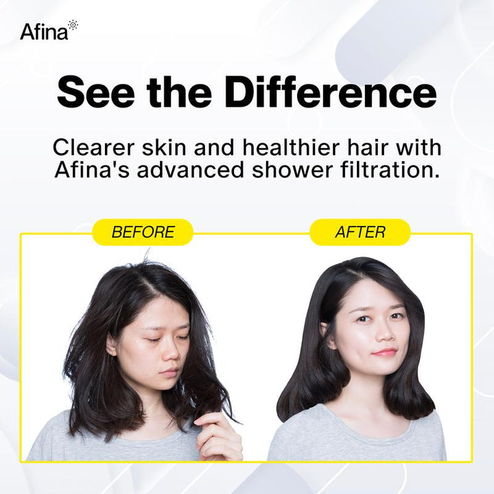 Revitalize Your Shower Experience: Afina High Pressure Filtered Shower Head for Healthier Skin, Hair & Nails - Say Goodbye to Dryness, Dandruff & Eczema!