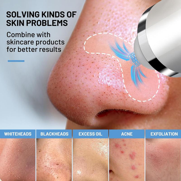 Fulog Blackhead Remover Vacuum - USB Pore Cleaner with Camera, 3 Suction Heads & Adjustable Modes - Perfect Gift for Women on Christmas & Thanksgiving!